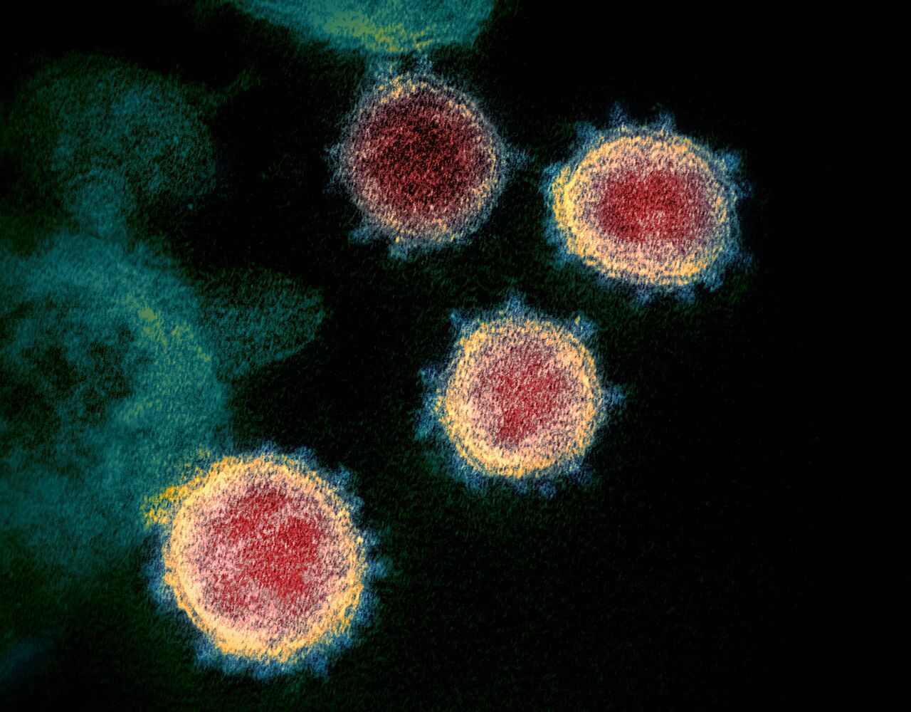 Maladies et virus